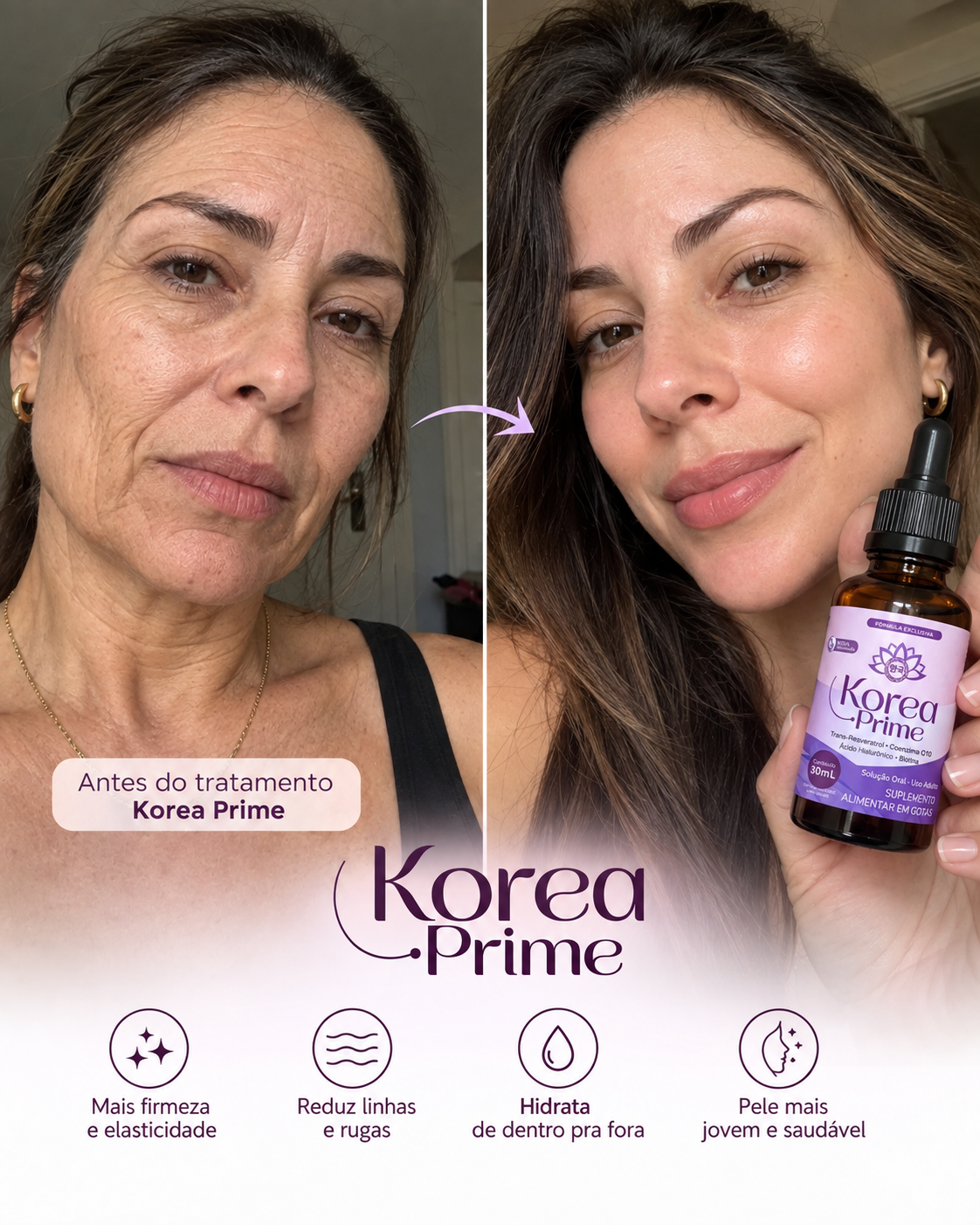 Antes e depois Korea Prime